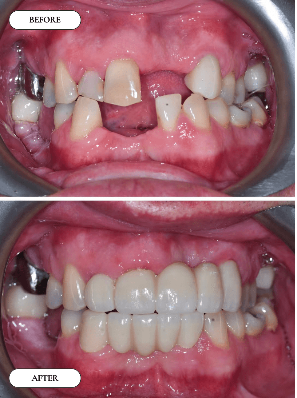 Smile Gallery 2